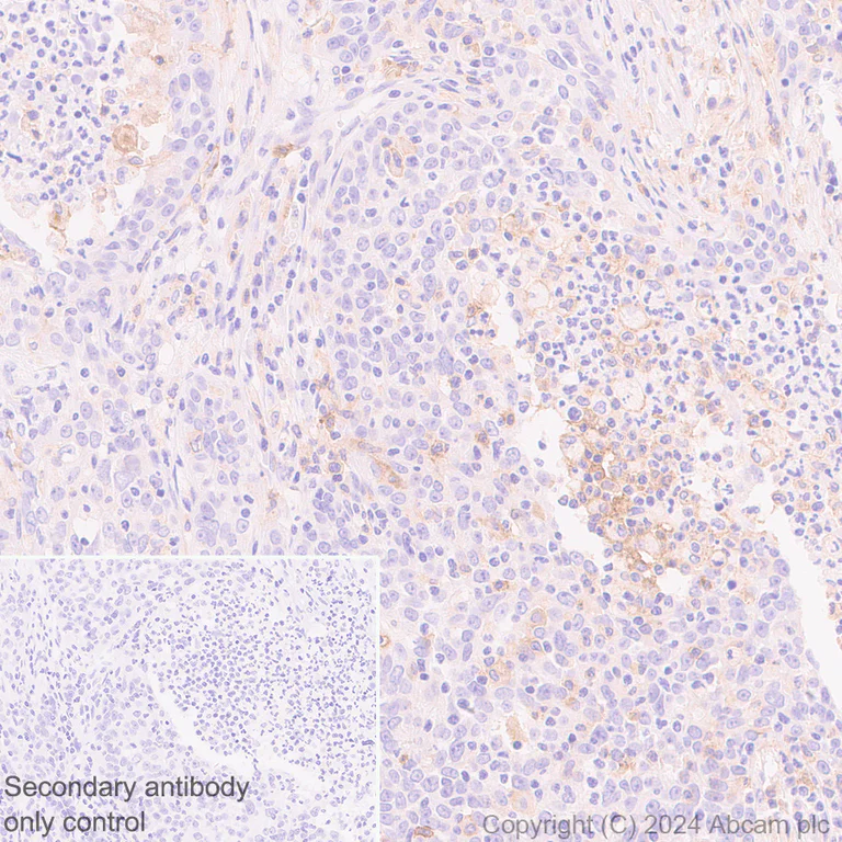Immunohistochemistry (Formalin/PFA-fixed paraffin-embedded sections) - Anti-CD86 antibody [EPR28721-30] - BSA and Azide free (AB317267)