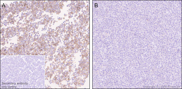 Immunohistochemistry (Formalin/PFA-fixed paraffin-embedded sections) - Anti-CD86 antibody [EPR28721-30] - BSA and Azide free (AB317267)