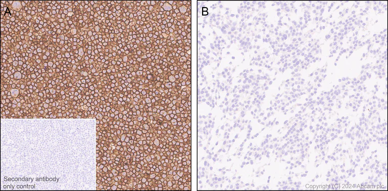 Immunohistochemistry (Formalin/PFA-fixed paraffin-embedded sections) - Anti-CD86 antibody [EPR28721-30] - BSA and Azide free (AB317267)