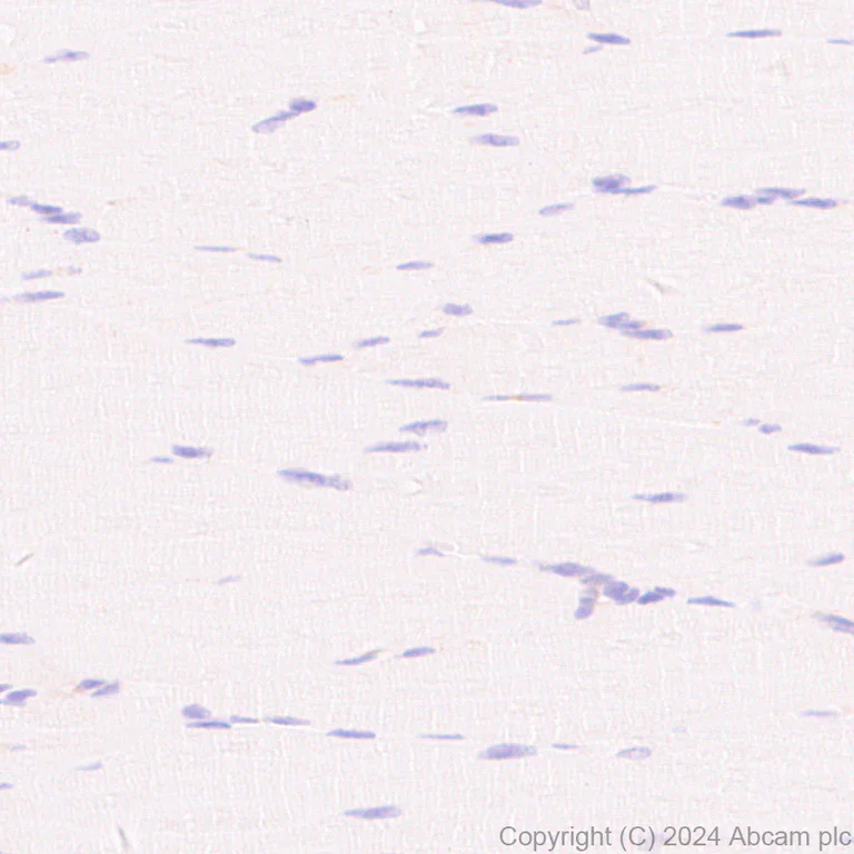 Immunohistochemistry (Formalin/PFA-fixed paraffin-embedded sections) - Anti-CD86 antibody [EPR28721-30] - BSA and Azide free (AB317267)