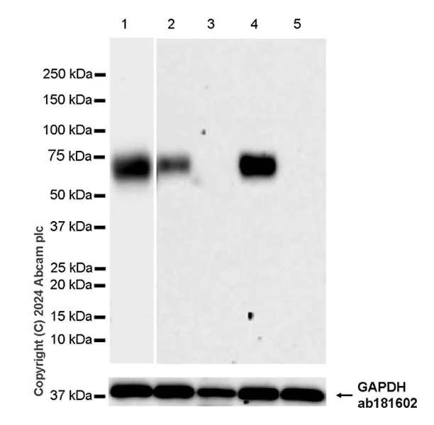 Western blot - Anti-CD86 antibody [EPR28721-30] - BSA and Azide free (AB317267)