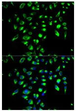 Immunocytochemistry/ Immunofluorescence - Anti-CD86 antibody - N-terminal (AB196564)