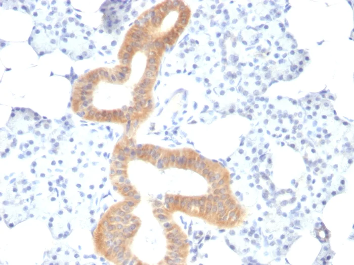 Immunohistochemistry (Formalin/PFA-fixed paraffin-embedded sections) - Anti-CD86 antibody [SPM600] (AB270719)
