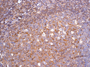 Immunohistochemistry (Formalin/PFA-fixed paraffin-embedded sections) - Anti-CD89 antibody [EPR4622(2)] (AB124717), expandable thumbnail
