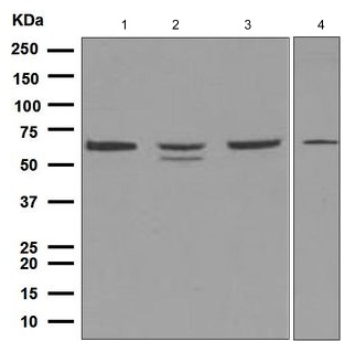 Western blot - Anti-CD89 antibody [EPR4622(2)] (AB124717), expandable thumbnail