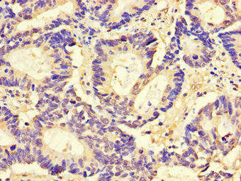 Immunohistochemistry (Formalin/PFA-fixed paraffin-embedded sections) - Anti-CD9 antibody (AB223052), expandable thumbnail