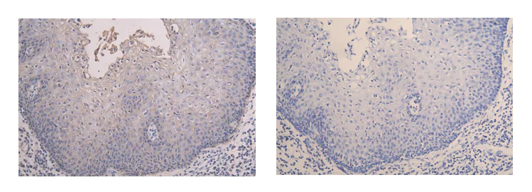 Immunohistochemistry (Formalin/PFA-fixed paraffin-embedded sections) - Anti-CD9 antibody (AB223052)