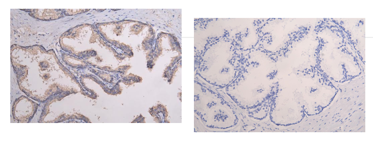 Immunohistochemistry (Formalin/PFA-fixed paraffin-embedded sections) - Anti-CD9 antibody (ab223052), expandable thumbnail