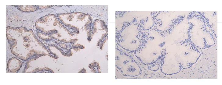 Immunohistochemistry (Formalin/PFA-fixed paraffin-embedded sections) - Anti-CD9 antibody (AB223052)