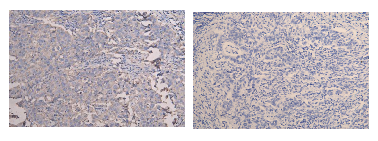 Immunohistochemistry (Formalin/PFA-fixed paraffin-embedded sections) - Anti-CD9 antibody (ab223052), expandable thumbnail