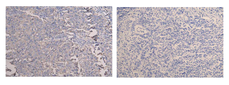 Immunohistochemistry (Formalin/PFA-fixed paraffin-embedded sections) - Anti-CD9 antibody (AB223052)