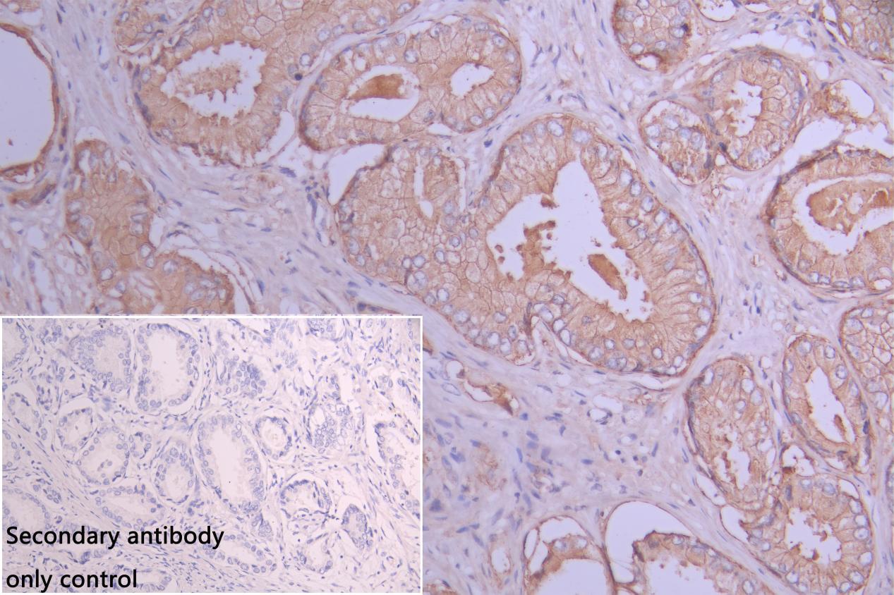 Immunohistochemistry (Formalin/PFA-fixed paraffin-embedded sections) - Anti-CD9 antibody (AB223052)