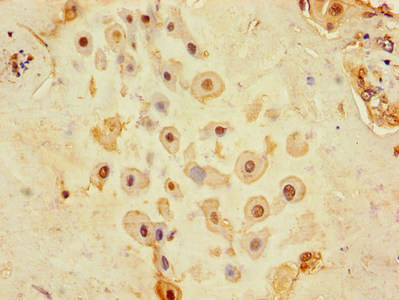 Immunohistochemistry (Formalin/PFA-fixed paraffin-embedded sections) - Anti-CD9 antibody (AB223052), expandable thumbnail