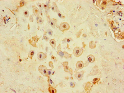 Immunohistochemistry (Formalin/PFA-fixed paraffin-embedded sections) - Anti-CD9 antibody (AB223052)
