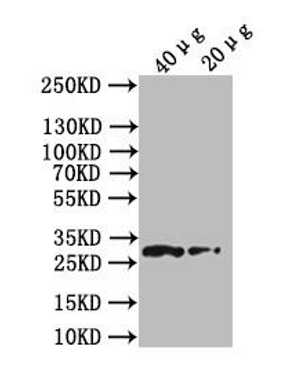 Western blot - Anti-CD9 antibody (AB223052), expandable thumbnail
