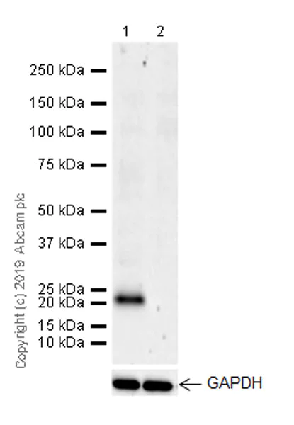Western blot - Anti-CD9 antibody [EPR23105-121] (AB236630)