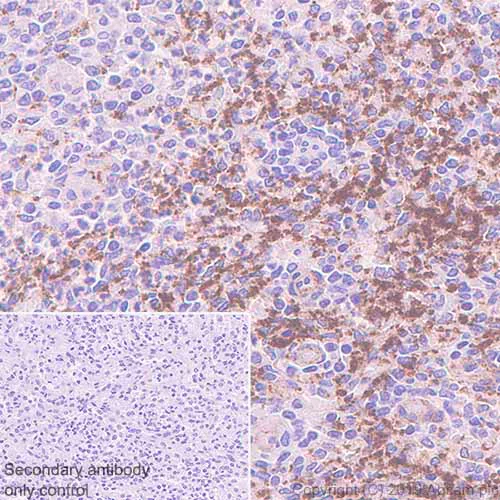 Immunohistochemistry (Formalin/PFA-fixed paraffin-embedded sections) - Anti-CD9 antibody [EPR23105-125] (AB263019)