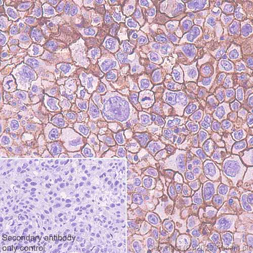 Immunohistochemistry (Formalin/PFA-fixed paraffin-embedded sections) - Anti-CD9 antibody [EPR23105-125] (AB263019)