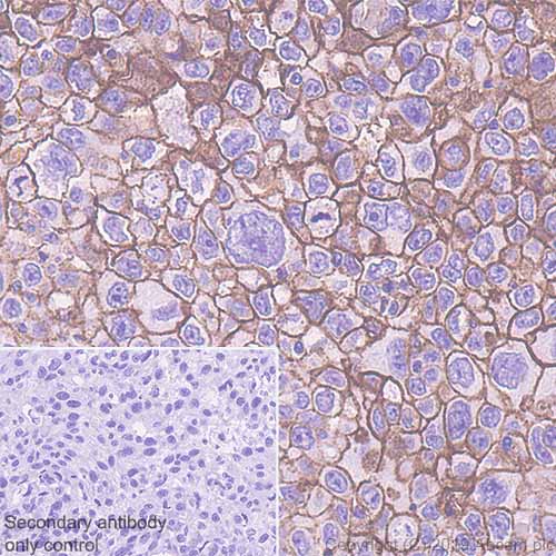 Immunohistochemistry (Formalin/PFA-fixed paraffin-embedded sections) - Anti-CD9 antibody [EPR23105-125] - BSA and Azide free (AB263024), expandable thumbnail