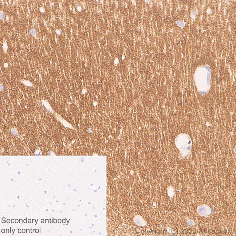 Immunohistochemistry (Formalin/PFA-fixed paraffin-embedded sections) - Anti-CD9 antibody [EPR27551-92] (AB307085)
