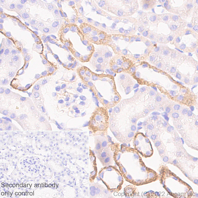 Immunohistochemistry (Formalin/PFA-fixed paraffin-embedded sections) - Anti-CD9 antibody [EPR27551-92] (AB307085)