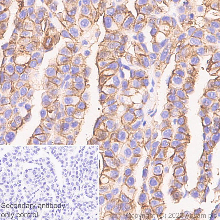 Immunohistochemistry (Formalin/PFA-fixed paraffin-embedded sections) - Anti-CD9 antibody [EPR27551-92] (AB307085)