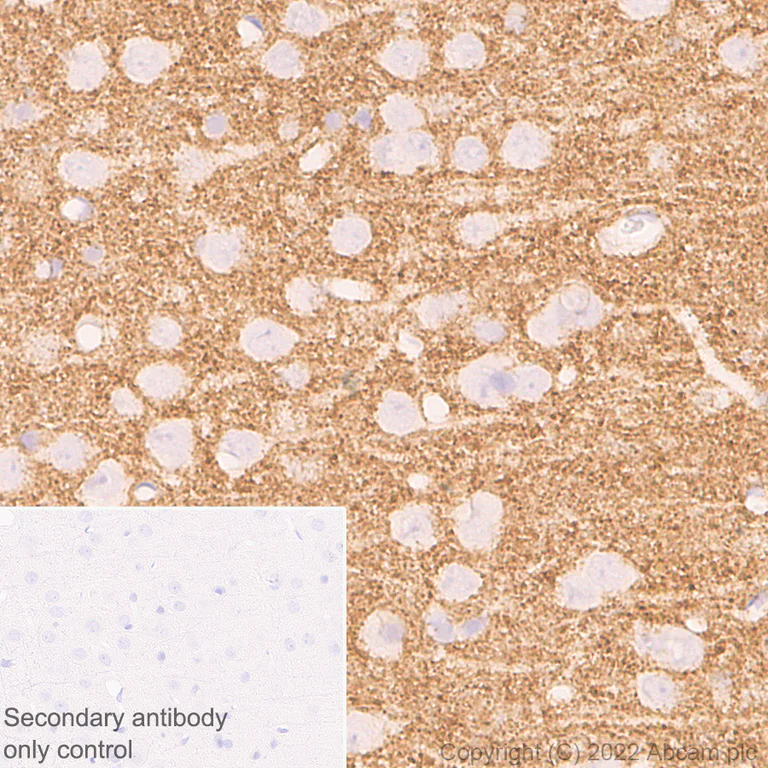 Immunohistochemistry (Formalin/PFA-fixed paraffin-embedded sections) - Anti-CD9 antibody [EPR27551-92] (AB307085)
