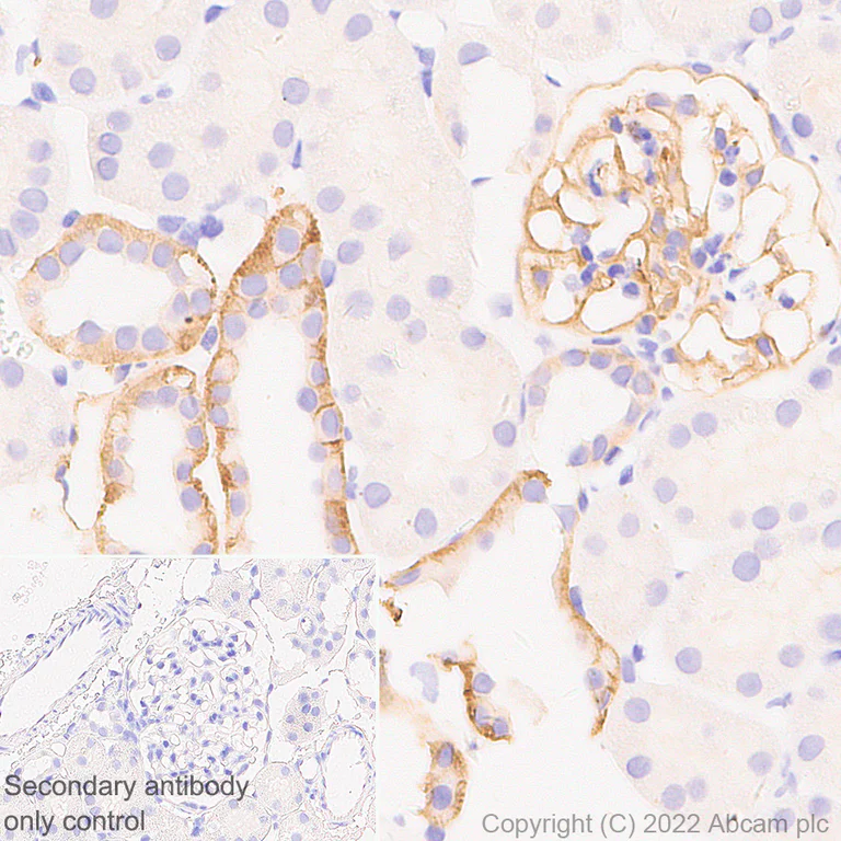 Immunohistochemistry (Formalin/PFA-fixed paraffin-embedded sections) - Anti-CD9 antibody [EPR27551-92] (AB307085)