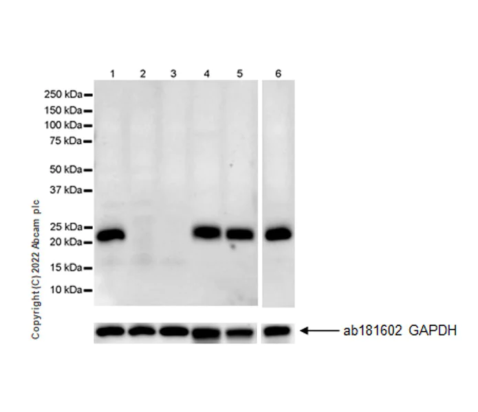 Western blot - Anti-CD9 antibody [EPR27551-92] (AB307085)