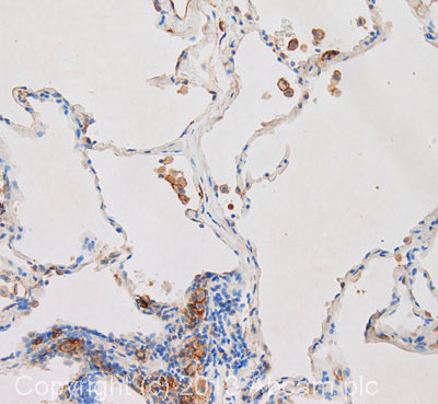 Immunohistochemistry (Formalin/PFA-fixed paraffin-embedded sections) - Anti-CD9 antibody [MEM-61] (AB2215), expandable thumbnail