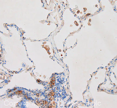 Immunohistochemistry (Formalin/PFA-fixed paraffin-embedded sections) - Anti-CD9 antibody [MEM-61] (AB2215)