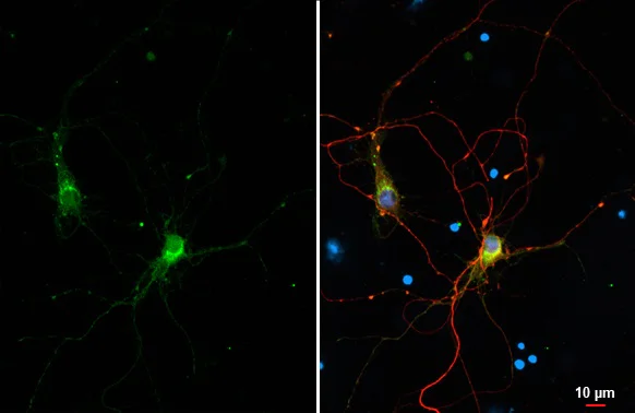 Immunocytochemistry/ Immunofluorescence - Anti-CD90 antibody [HL1766] - BSA and Azide free (AB308195)
