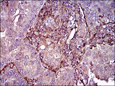 Immunohistochemistry (Formalin/PFA-fixed paraffin-embedded sections) - Anti-CD90 / Thy1 antibody [7E1B11] (AB181469)