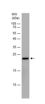 Western blot - Anti-CD90 / Thy1 antibody (AB273071)