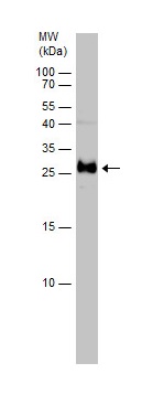 Western blot - Anti-CD90 / Thy1 antibody (AB273071), expandable thumbnail