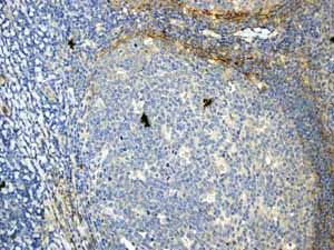 Immunohistochemistry (Formalin/PFA-fixed paraffin-embedded sections) - Anti-CD90 / Thy1 antibody [EPR3132] (AB92574)
