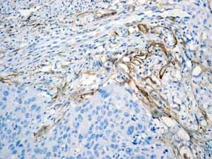 Immunohistochemistry (Formalin/PFA-fixed paraffin-embedded sections) - Anti-CD90 / Thy1 antibody [EPR3132] (AB92574)