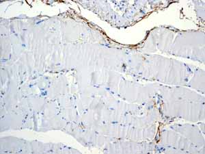Immunohistochemistry (Formalin/PFA-fixed paraffin-embedded sections) - Anti-CD90 / Thy1 antibody [EPR3132] (AB92574), expandable thumbnail