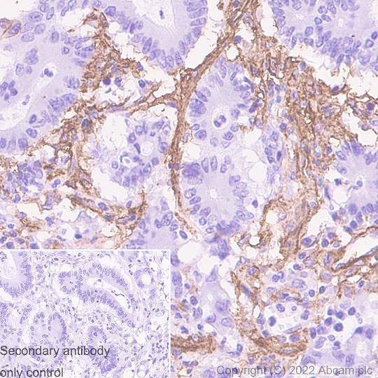 Immunohistochemistry (Formalin/PFA-fixed paraffin-embedded sections) - Anti-CD90 / Thy1 antibody [EPR3132] (ab92574), expandable thumbnail