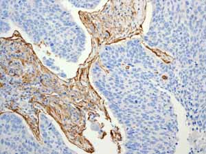 Immunohistochemistry (Formalin/PFA-fixed paraffin-embedded sections) - Anti-CD90 / Thy1 antibody [EPR3132] (ab92574), expandable thumbnail