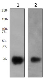 Western blot - Anti-CD90 / Thy1 antibody [EPR3132] (AB92574), expandable thumbnail