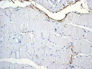 Immunohistochemistry (Formalin/PFA-fixed paraffin-embedded sections) - Anti-CD90 / Thy1 antibody [EPR3132] - BSA and Azide free (AB181885)