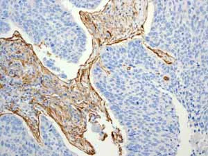 Immunohistochemistry (Formalin/PFA-fixed paraffin-embedded sections) - Anti-CD90 / Thy1 antibody [EPR3132] - BSA and Azide free (AB181885)