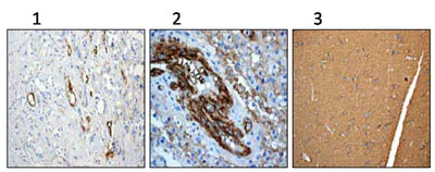 Immunohistochemistry (Formalin/PFA-fixed paraffin-embedded sections) - Anti-CD90 / Thy1 antibody [EPR3132] - Low endotoxin, Azide free (AB221607)