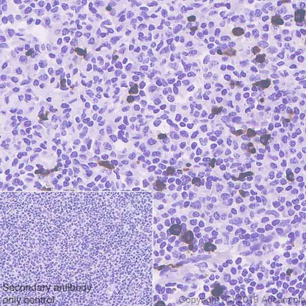 Immunohistochemistry (Formalin/PFA-fixed paraffin-embedded sections) - Anti-CD90 / Thy1 antibody [EPR3133] - BSA and Azide free (AB226123), expandable thumbnail