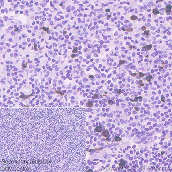 Immunohistochemistry (Formalin/PFA-fixed paraffin-embedded sections) - Anti-CD90 / Thy1 antibody [EPR3133] - Low endotoxin, Azide free (AB216449)
