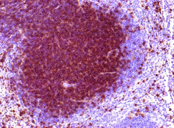 Immunohistochemistry (Formalin/PFA-fixed paraffin-embedded sections) - Anti-CD90 / Thy1 antibody [IBL-6/23] (AB3105)