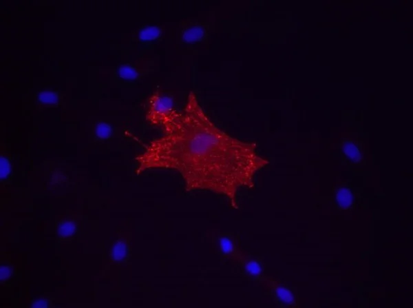 Immunocytochemistry - Anti-CD90 / Thy1 antibody [MRC OX-7] - Hematopoietic Stem Cell Marker (AB225)