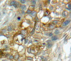 Immunohistochemistry (Formalin/PFA-fixed paraffin-embedded sections) - Anti-CD93 antibody (AB231960), expandable thumbnail
