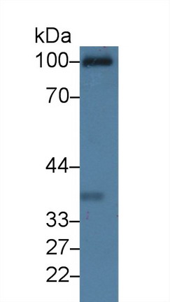 Western blot - Anti-CD93 antibody (AB231960), expandable thumbnail